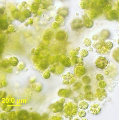 ファイル:Chlorella with light microscopy.jpg